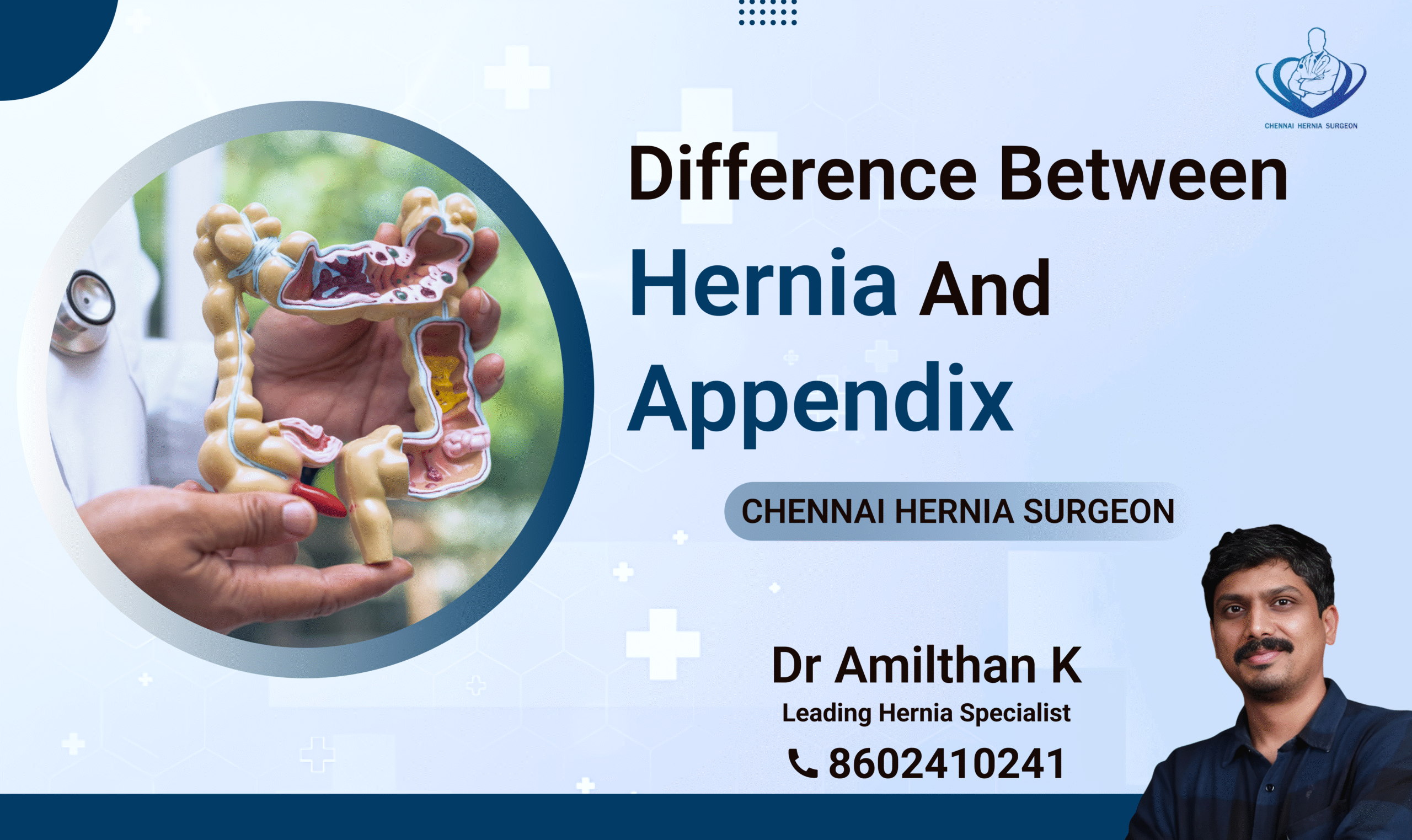 Difference Between Hernia And Appendix